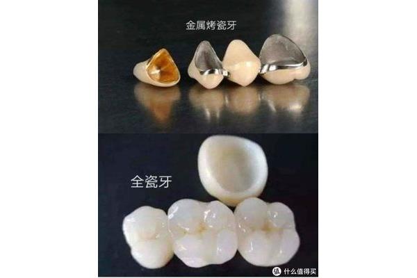 ǽن?䓺ʯĂ(g)?