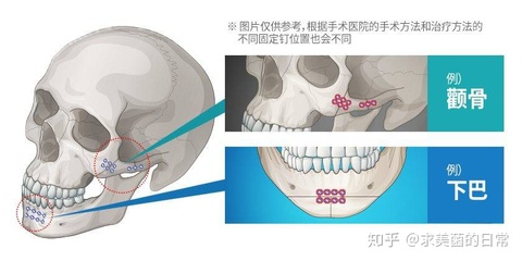 ȡ⁺Ͻӹǰ⁽ӹǰҪL(zhng)r(sh)g?