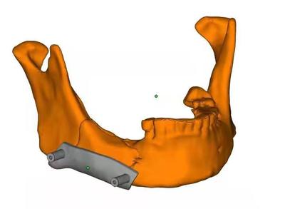 MǷԹ⁰߀Ҫȡ?