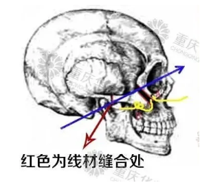 ⁰ĥ,ᔺ⁽z̶Ă(g)?