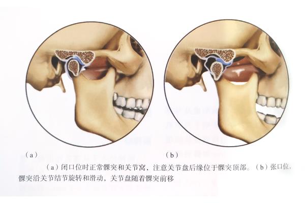 DMP(gun)(ji)ɁyP(gun)(ji)Rg(sh),MP(gun)(ji)Ɂyôί?