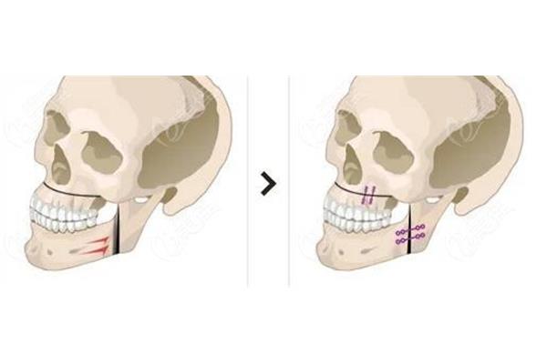 ⁰ȡg(sh)M(fi)Ƕ?⁰ô